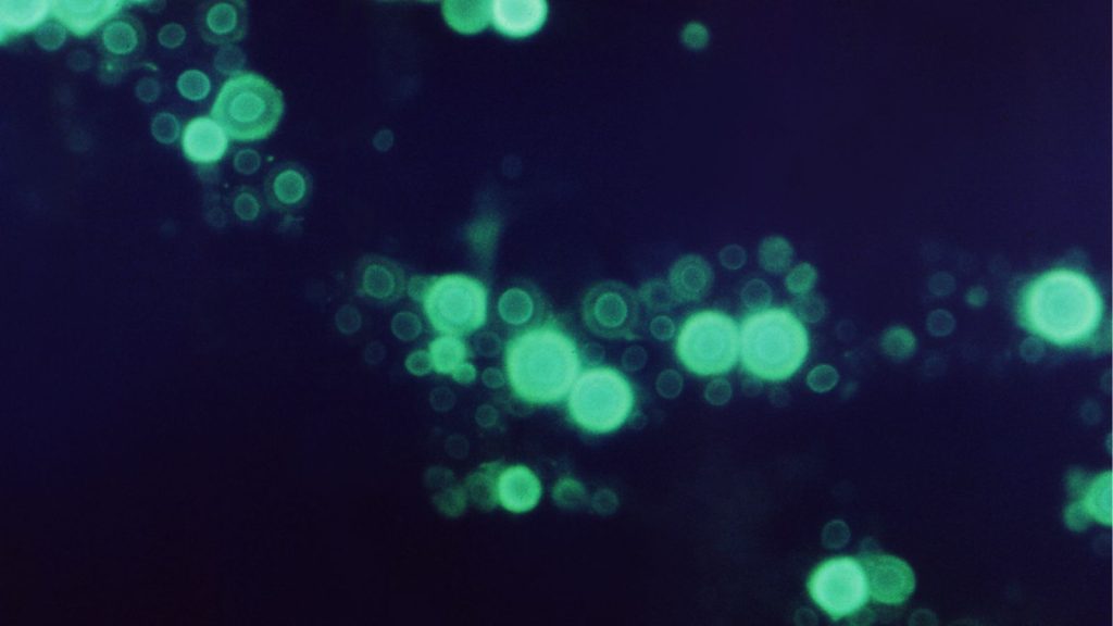 ウイルスの写真